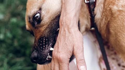 Dadar: Pet Dog Bites 7-Year-Old Boy on Hand; Case Registered Against Owner