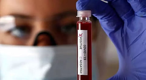 One-year-old child tests COVID-19 positive in Biswanath district