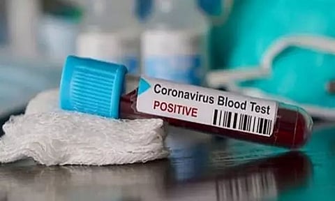 Representational Image