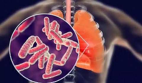 Sounding tuberculosis alarm