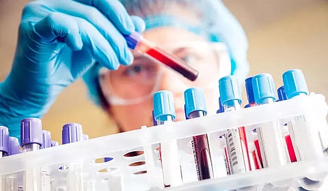 20-minute COVID-19 blood test developed by Australia Monash University