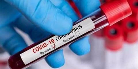 12 new COVID cases in Meghalaya