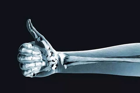 Importance of Bone Health