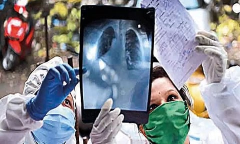 Delhi: Corona Virus Making Inroads Deep Into Lungs, Difficult to Diagnose