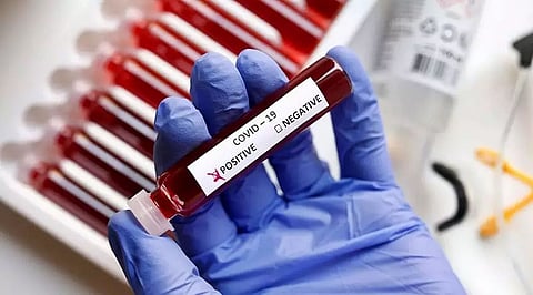 17 students, 4 teachers test positive for COVID-19 in Sivasagar