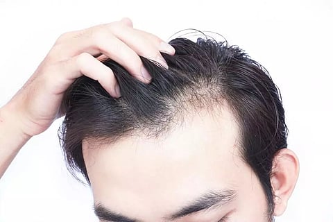 Reasons that cause hair thinning