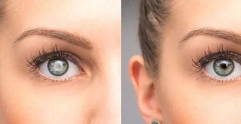 Loss of vision: After cataract, glaucoma major health issue