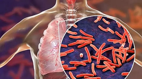 SRD Group of Companies signs LoI with District TB Cell, Darrang