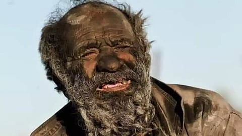 Dirtiest Man in the World Passes Away at the Age of 94