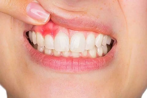 For Healthy Pink Gums and Teeth