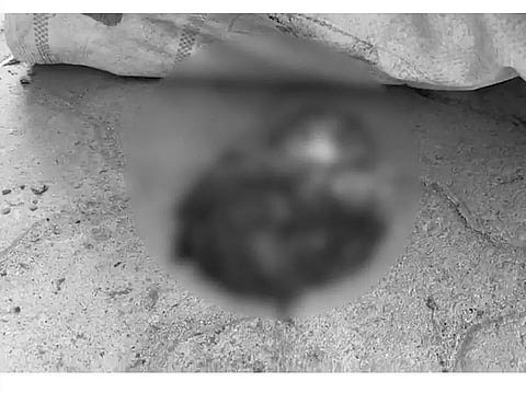 Assam: Infant's Head Spotted In Dibrugarh's PWD Colony