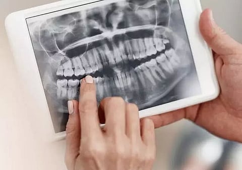 Why should you get a dental X-ray done?