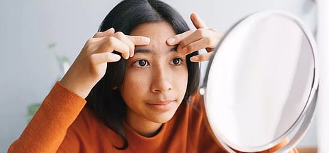 Pop these myths not your pimples!