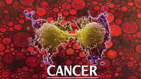 Meghalaya’s cancer scenario