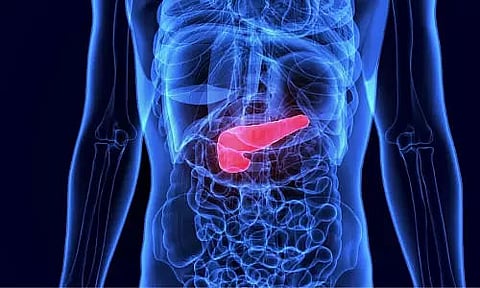 6 gallstones symptoms to know