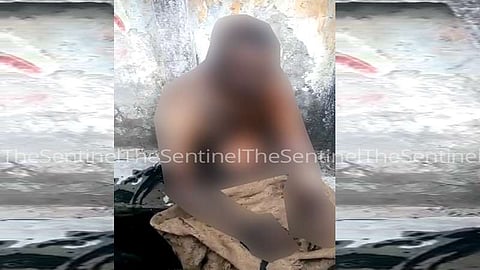 Youth set on fire by girlfriend expires