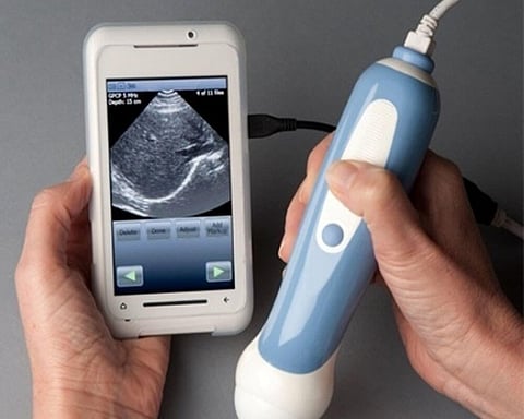 A Cheap, Portable Smartphone-Powered Ultrasound Machine