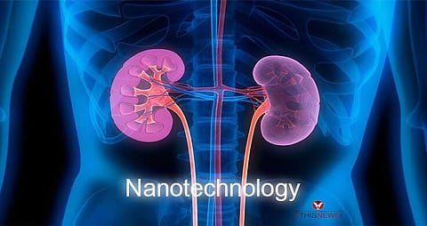 Nanotechnology Effective for Treating Acute Kidney Injury