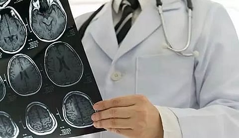 MINISTROKE VS REGULAR STROKE WHAT S THE DIFFERENCE visual data 7