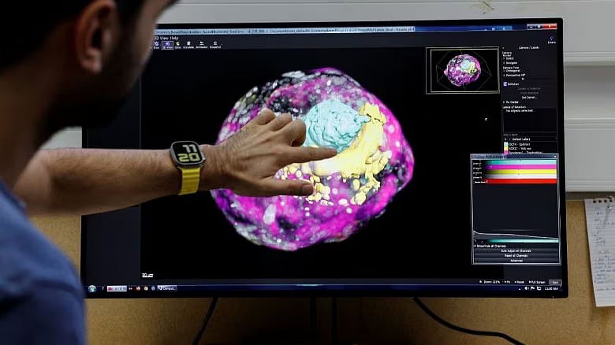 Israeli scientists create complete human-like embryo models from stem cells