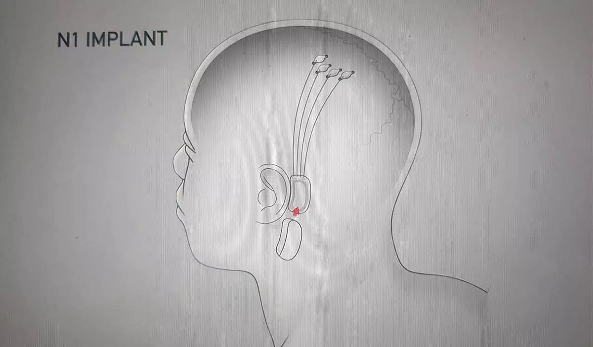 Neuralink Sentinel The Elite Hacker’s Playbook: Strategic Patience in the Age of AI