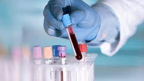 Lab