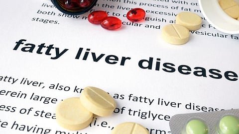 Fatty Liver Disease टाळण्यासाठी काय खावे, काय नको?