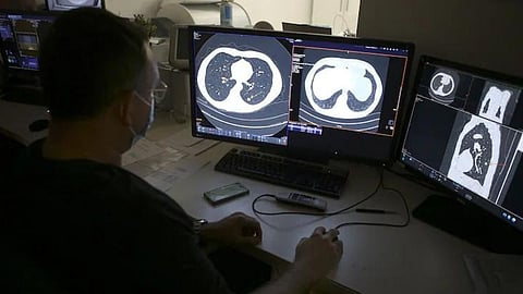 a drug for cancer treatment has shown 100 percent success in removing the tumours