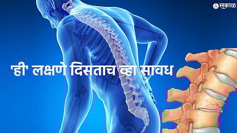 World Osteoporosis Day 2022