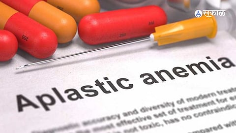 Thalassemia and Aplastic Anaemia