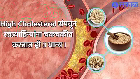 High Cholesterol Foods