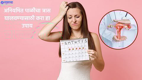 Irregular Periods
