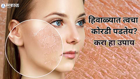 Dry Skin Care