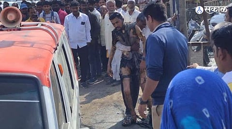 wagholi youth fire himself in front police station crime beating case