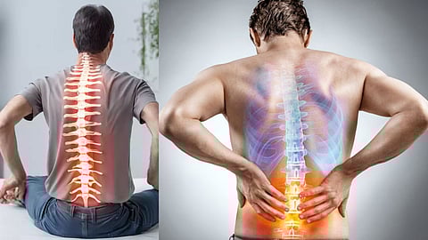 Spine Diseases