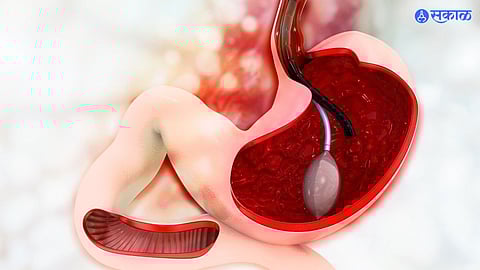 Esophagogastroduodenoscopy