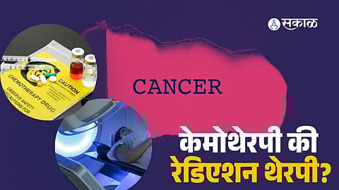 Chemotherapy vs Radiation Therapy: Understand the Right Cancer Treatment with Expert Advice