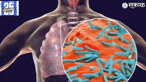 Central Health Committee visits Shigav and Ayushman Mandir after the identification of 488 tuberculosis patients in the district.