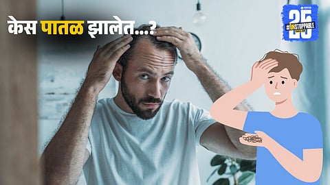 Men's Hair Loss Tips: