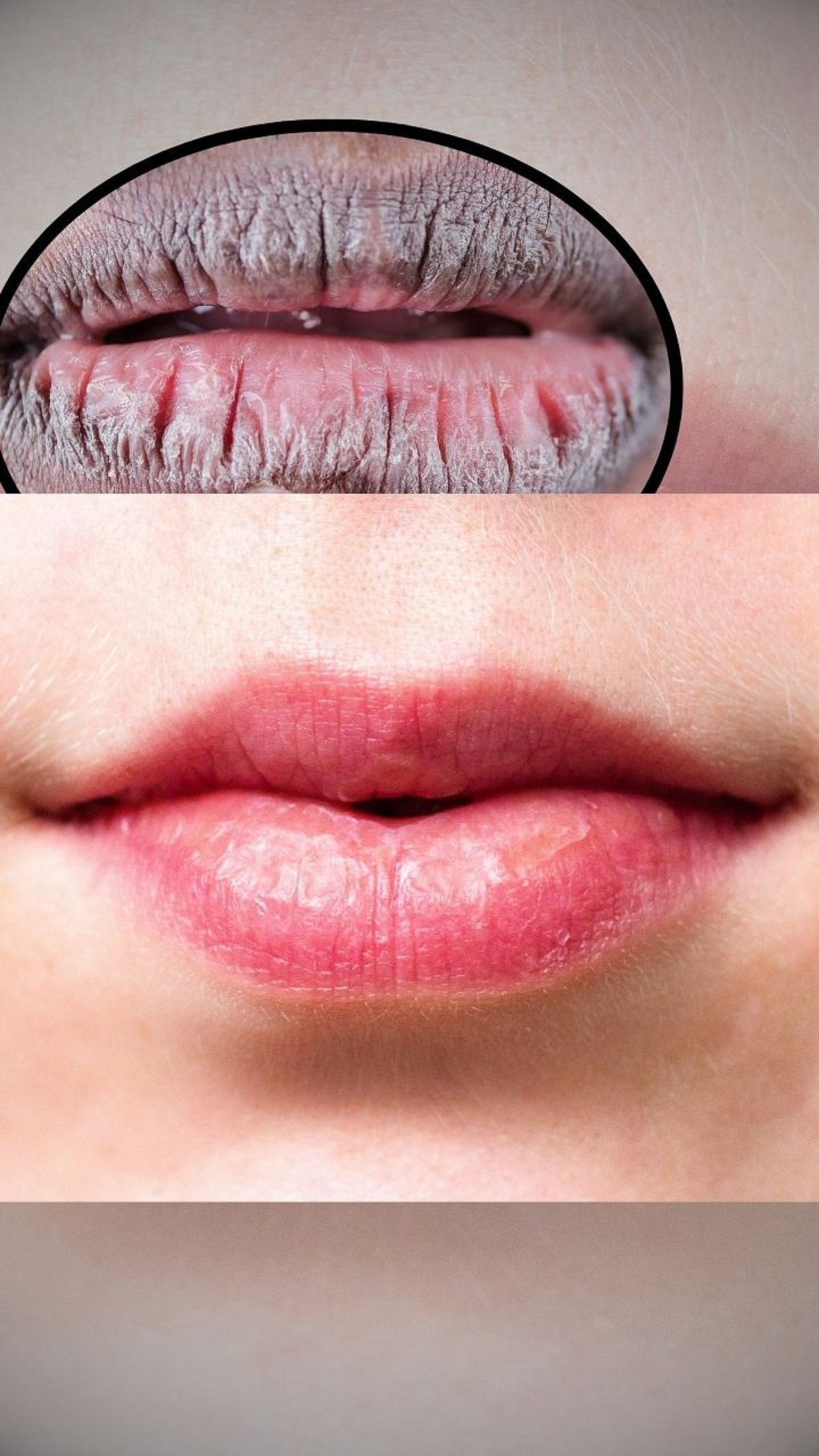 Effective Ways to Prevent Dark Lips and Keep Them Soft and Pink ...