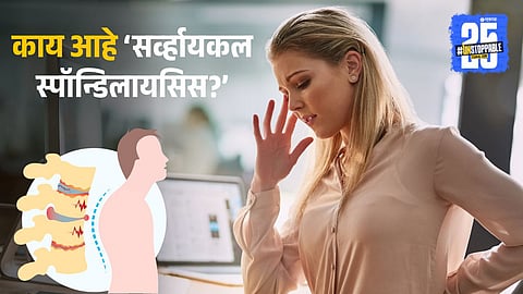 Cervical Spondylosis