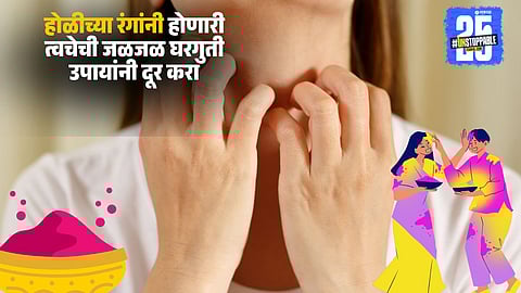 Holi Rashes Treatment Home Solutions