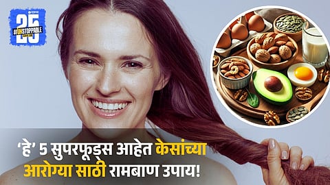 Biotin Rich Foods For Hair Growth