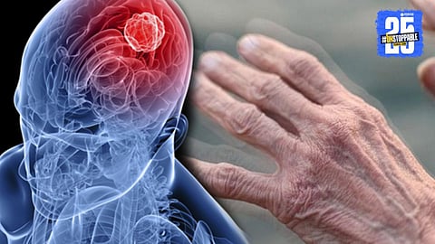 World Parkinson's Day