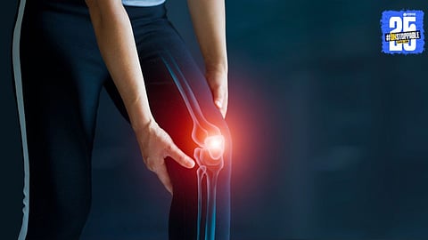 Arthritis