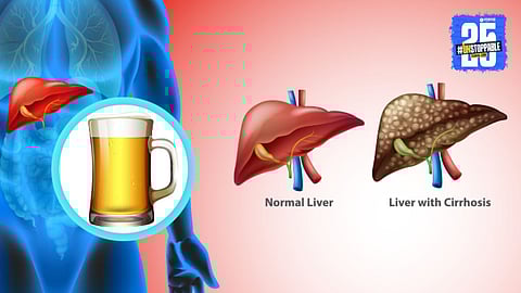 World Liver Day