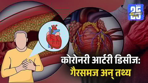 Coronary Artery Disease: Myths And Facts