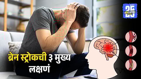 Symptoms Of Brain Stroke