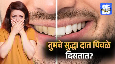 Dentist Recommended Teeth Whitening Tips