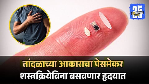 Heart Pacemaker| New Innovation In Health Sector